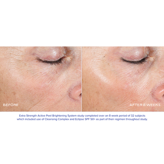 iS Clinical Extra Strength Active Peel Pads | Bare Complexion Acne & Skincare in Ventura, CA
