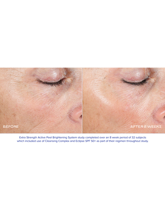 iS Clinical Extra Strength Active Peel Pads | Bare Complexion Acne & Skincare in Ventura, CA