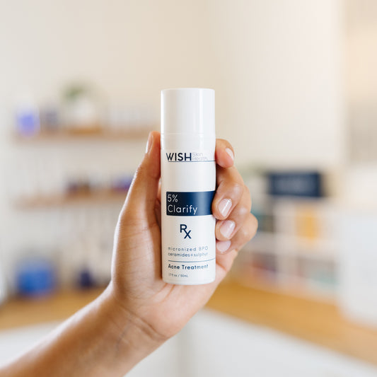 Hand holding a Wish 5% Clarify Acne Treatment bottle in an esthetician's office.